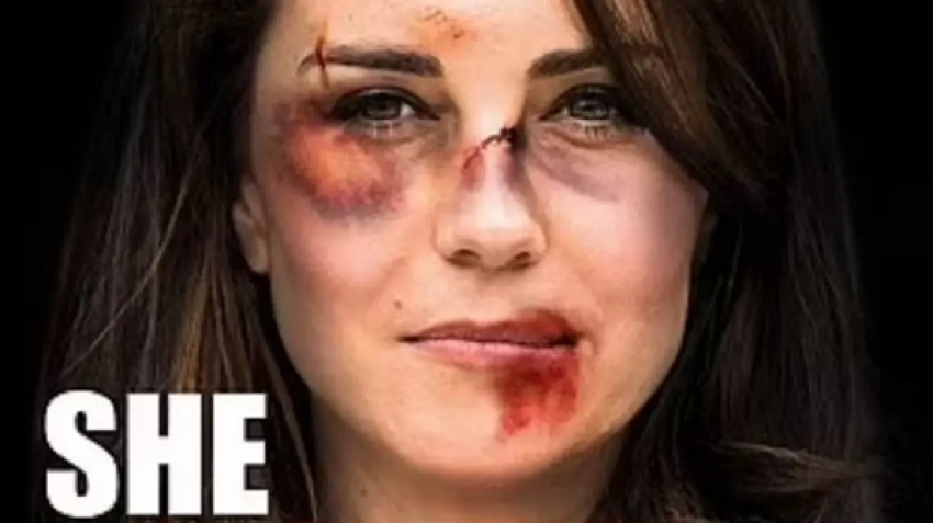صور مروعة لكيت ميدلتون .. في حملة  إنهاء العنف ضد المرأة